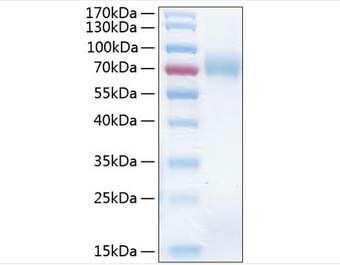 Myoferlin(MYOF)ͼƬ