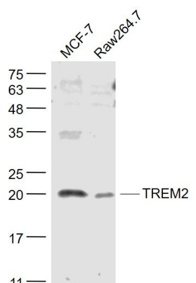TREM2 antibody,orb313249ͼƬ