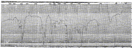 2-Heptenic aldehydeͼ1